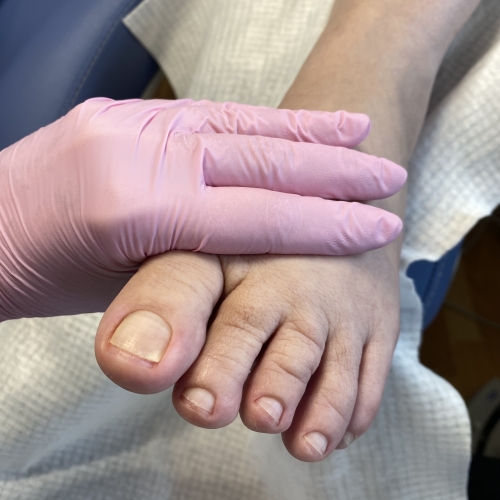 Fodpleje i Hals – fodterapeut udfører fodbehandling og neglepleje hos Hals Wellness