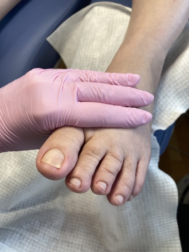 Fodpleje i Hals – fodterapeut udfører fodbehandling og neglepleje hos Hals Wellness
