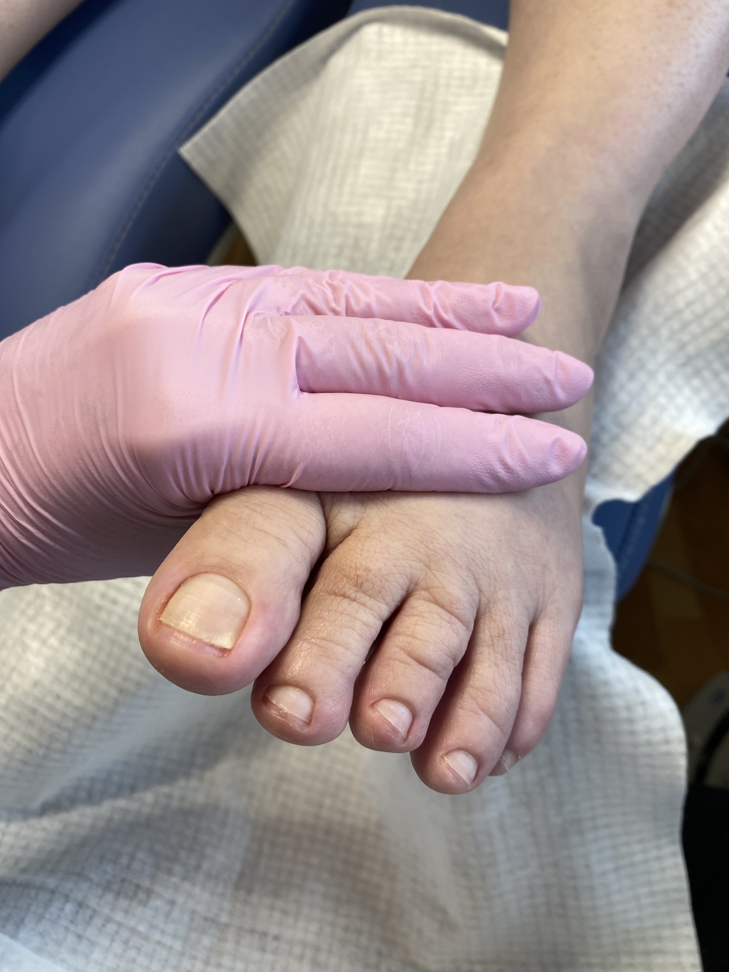 Fodpleje i Hals – fodterapeut udfører fodbehandling og neglepleje hos Hals Wellness